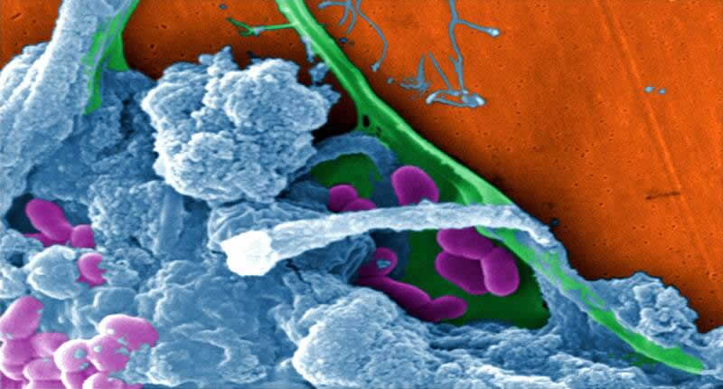 Infusoria - Mikroorganismen im Biofilm